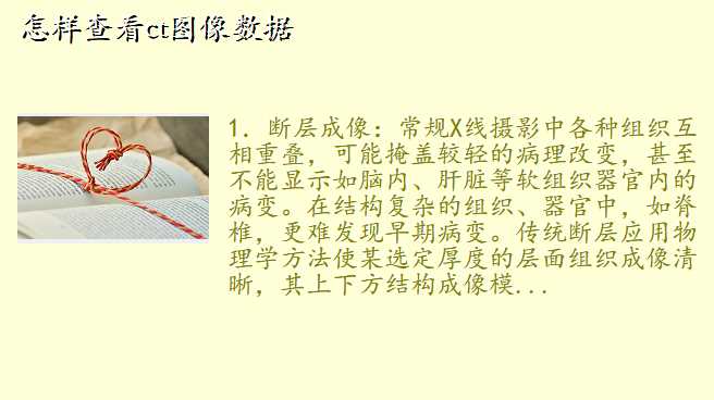 怎样查看ct图像数据